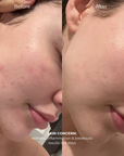 Skincare Faucet Filter - Bath Filter