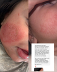 Skincare Faucet Filter - Bath Filter