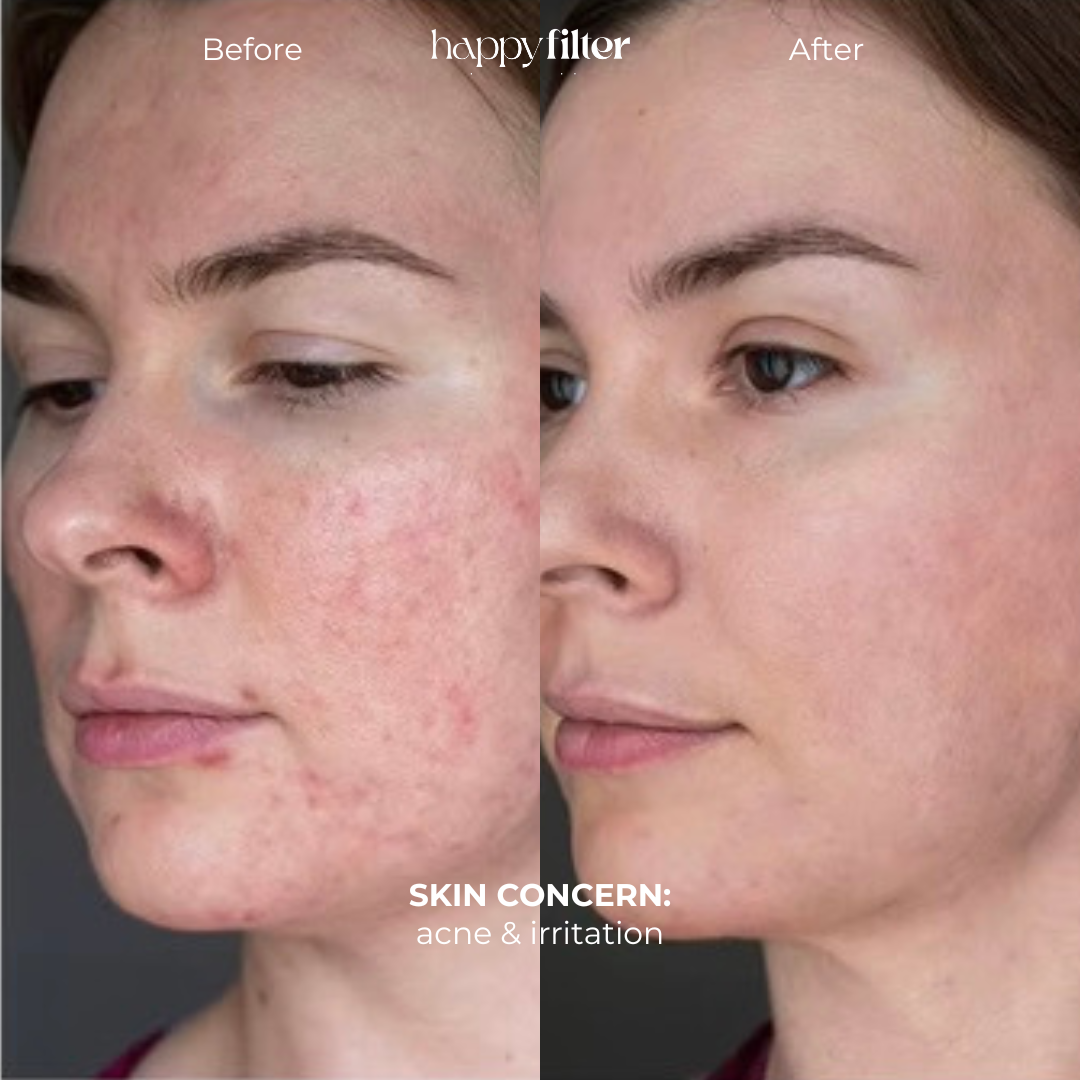 Skincare Faucet Filter - Bath Filter